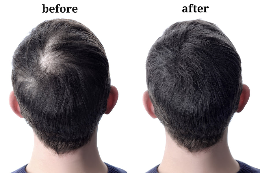 Instant Solution to Reversing Thinning Hair
